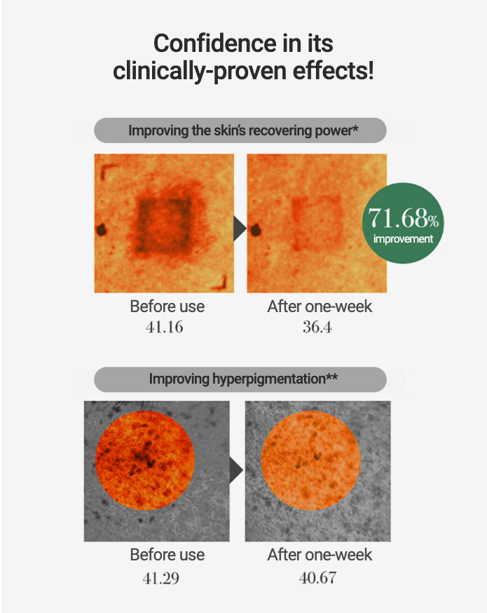 ★BESTSELLING★ Korean Sheet Mask - MEDIHEAL Madecassoside Essential Face Mask For All Skin Types